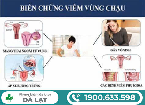 Hình ảnh minh họa